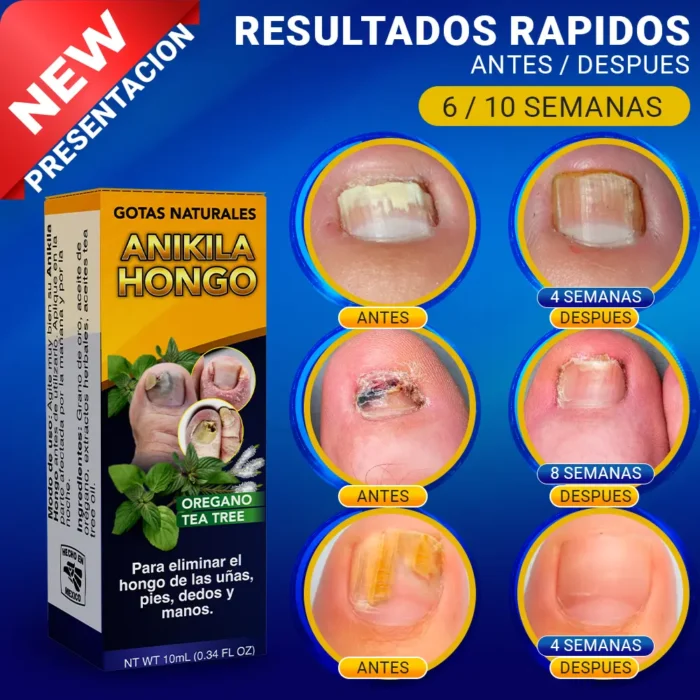 Anikila-Hongo-Nuva-Presentacion-10-ml-1-1